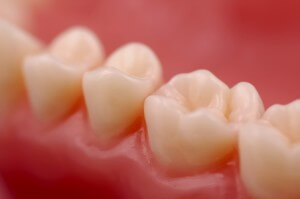 Avoid periodontal disease with good oral hygiene.